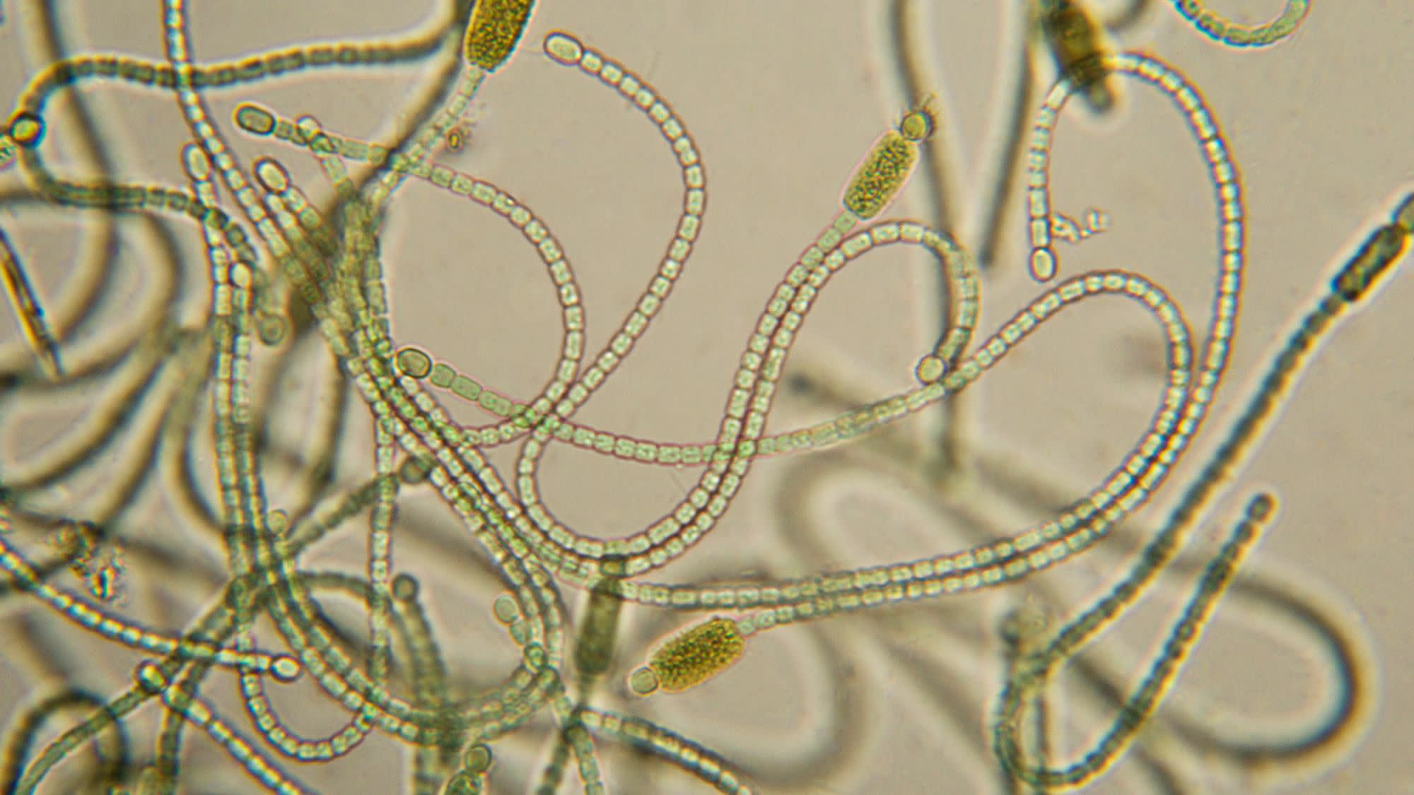 What Are Cyanobacteria, and How Are They Similar or Different From Plants?  - Owlcation