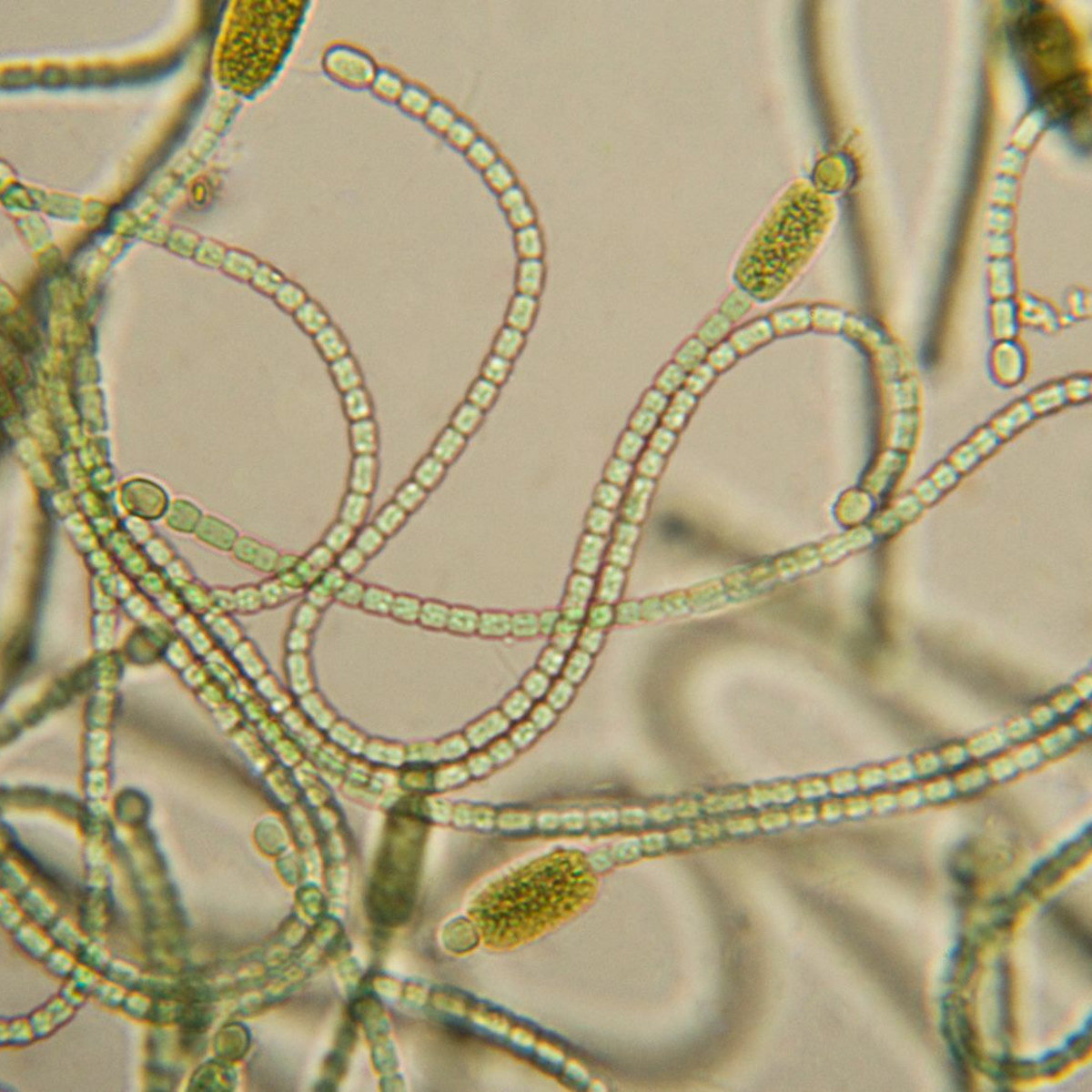 What Are Cyanobacteria, and How Are They Similar or Different From Plants?  - Owlcation