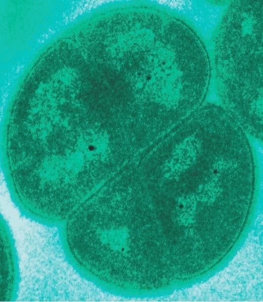 Unusual Bacteria: Strange Facts About Fascinating Microbes - Owlcation