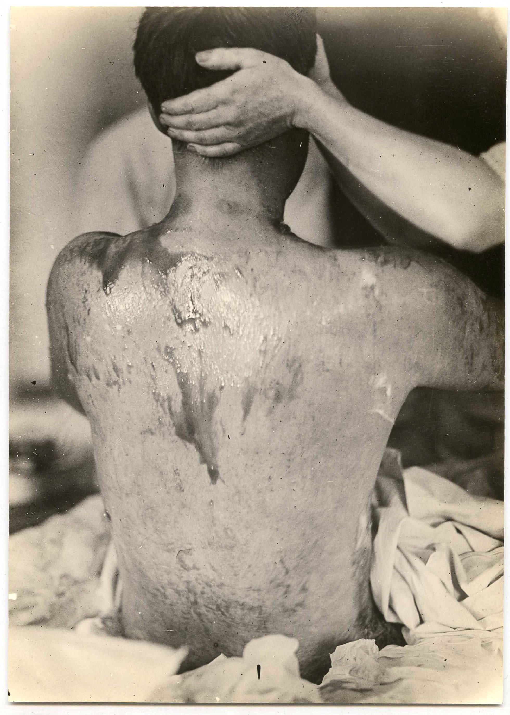 The Horrific Use of Chemical and Biological Weapons in World War I -  Owlcation, image size:1960x2744