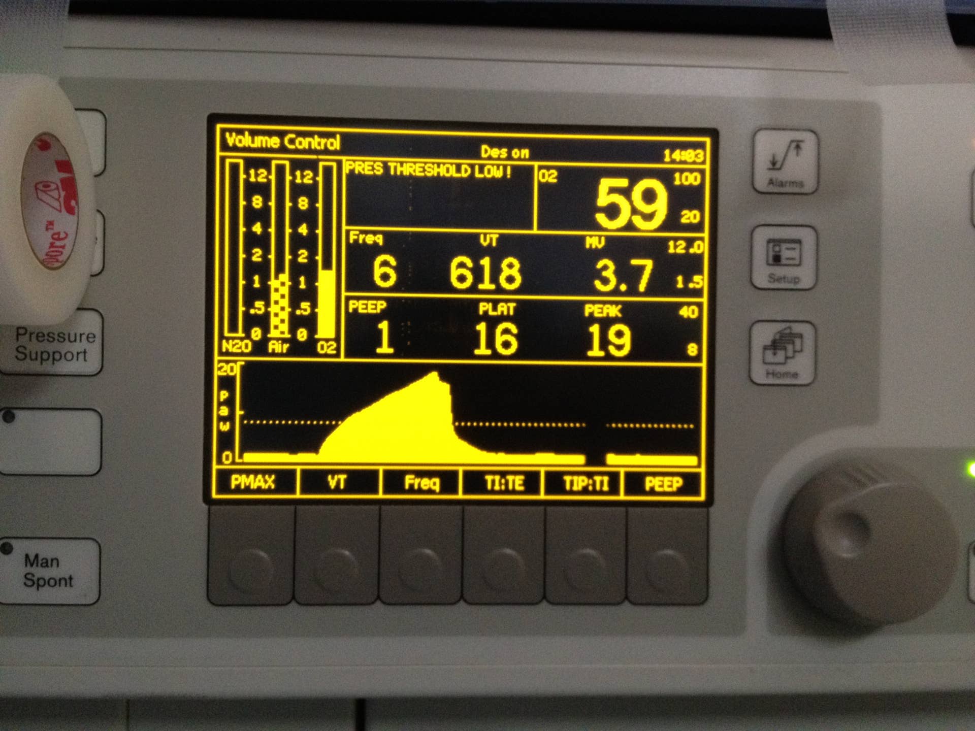 Is Breathing Over the Ventilator a Good Sign: Hope or Concern?